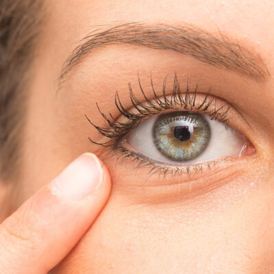 Eye Twitching – Types, Causes, and Remedies