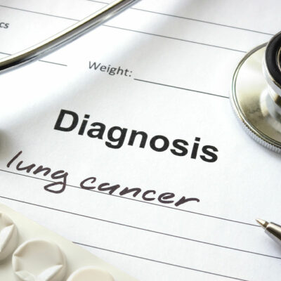 Lung Cancer – Types, Causes, and Symptoms