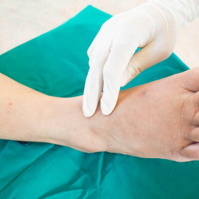 Neuropathy – An Overview