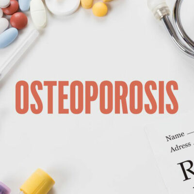 Bone density testing – An important diagnostic tool for osteoporosis
