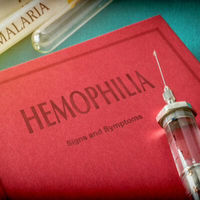 Hemophilia – 4 main symptoms and their severity